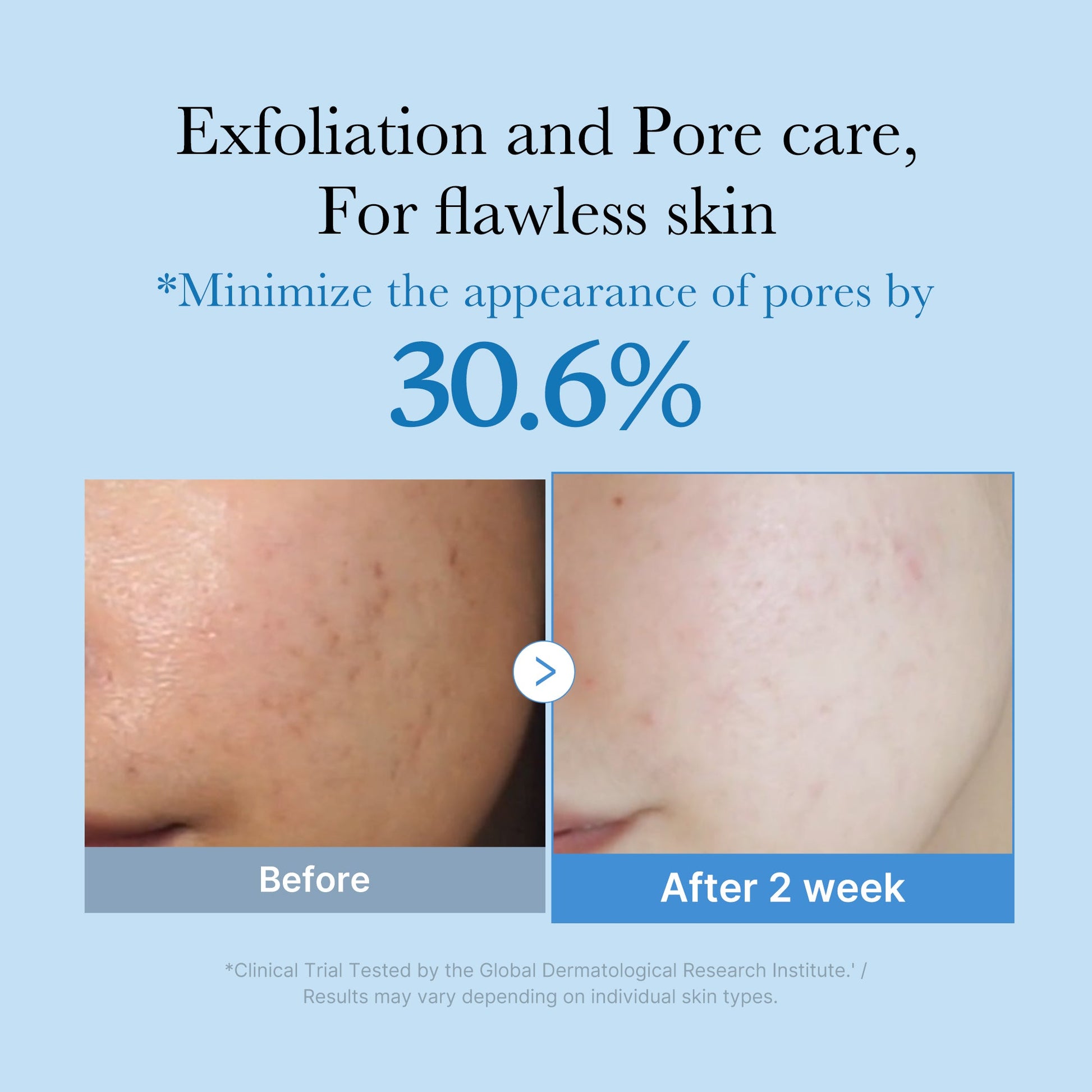 zero-pore-toner-m2 01_d6480b4e-3c08-4954-994a-ed5212c1839c.jpg