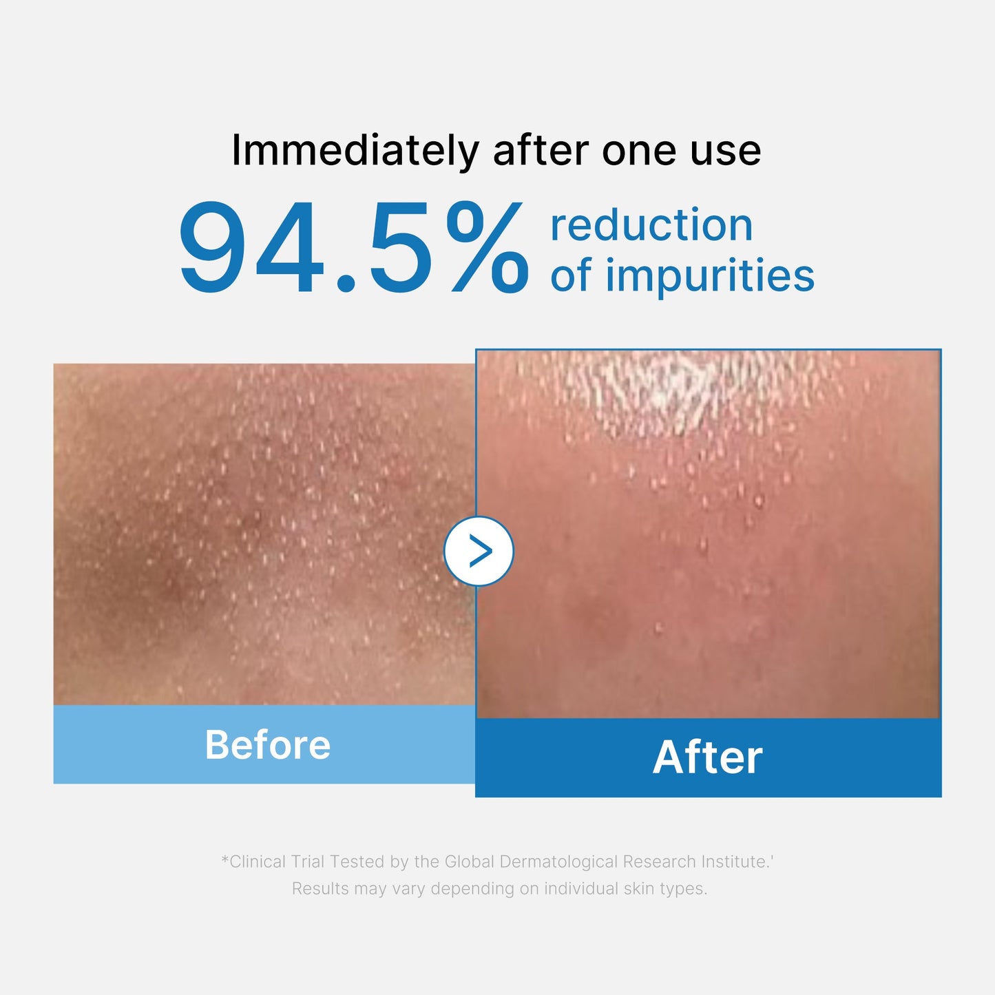 zero-pore-blackhead-deep-cleansing-oil-f9 01_eed557ec-5857-46a2-8b17-dbd67c692dcb.jpg