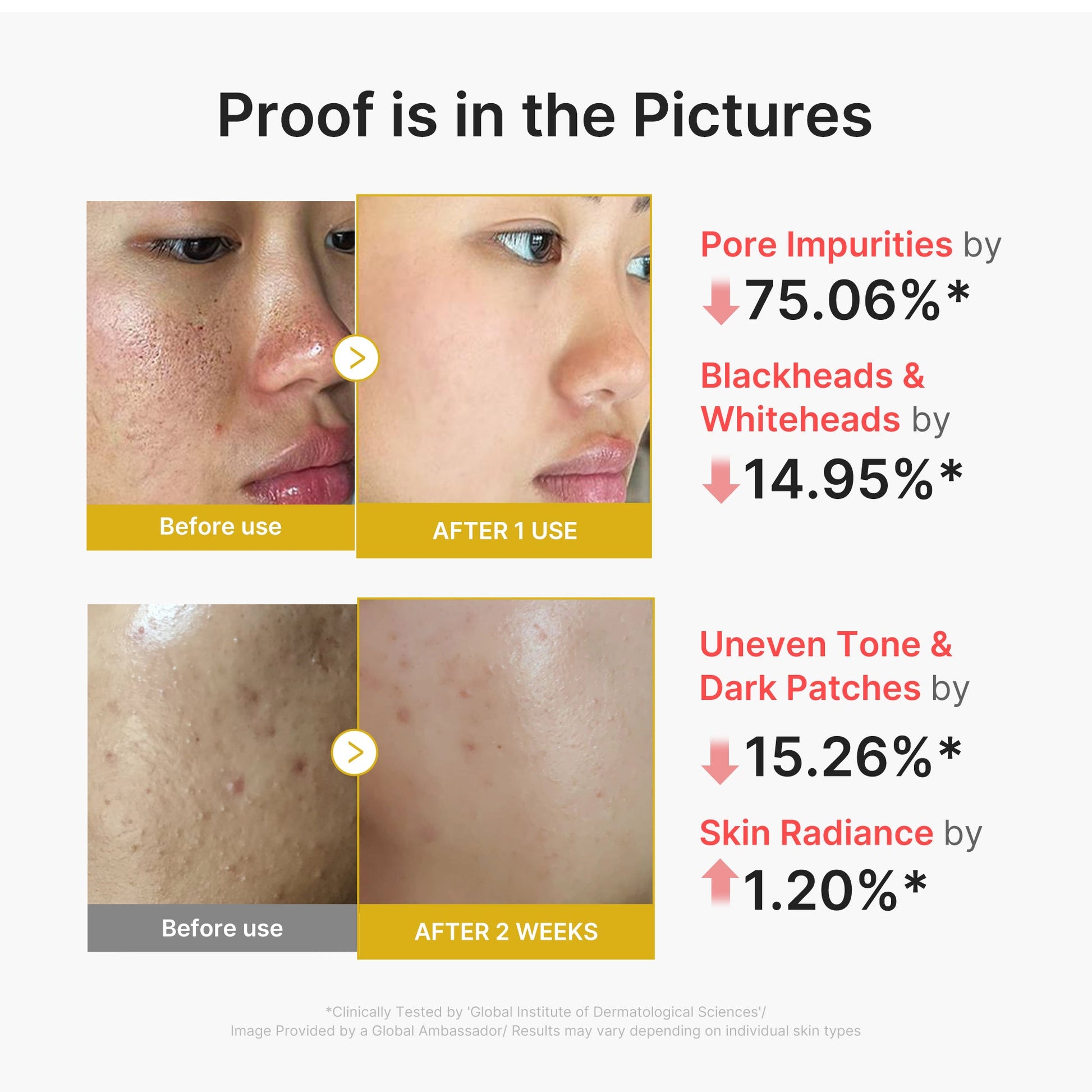 kojic-acid-turmeric-peel-shot-k0 02_45fe66d3-b3f6-4100-aa52-2afd7eded417.jpg