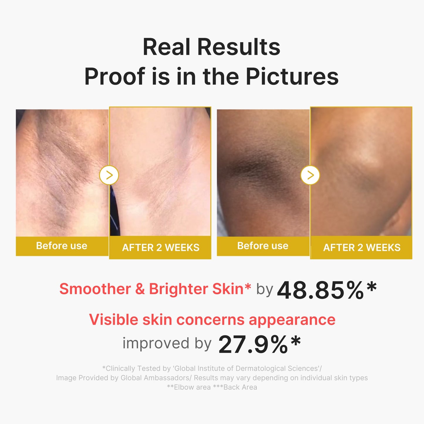 kojic-acid-turmeric-body-peel-shot-a8 02_72880cfc-382b-440b-8152-7e3dce87da2a.jpg
