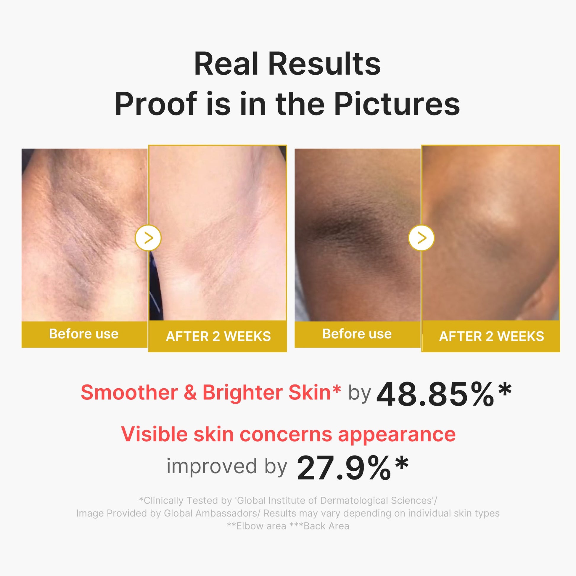 kojic-acid-turmeric-body-peel-shot-a8 02_72880cfc-382b-440b-8152-7e3dce87da2a.jpg