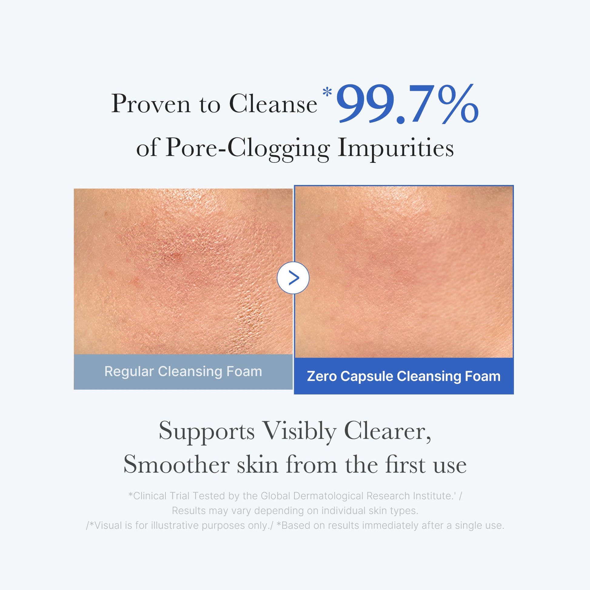 zero-pore-capsule-cleansing-foam-f4 02_c1fb9dfb-86c5-4038-8ff8-490d1006276c.jpg
