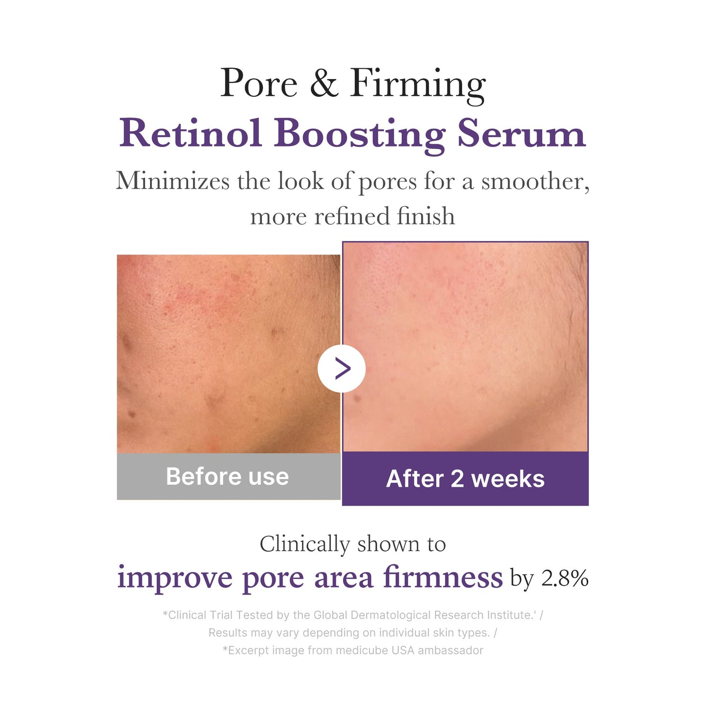 retinol-nmn-boosting-serum-v7 03_3510e7a5-5633-4a18-81ea-1389593bd517.jpg