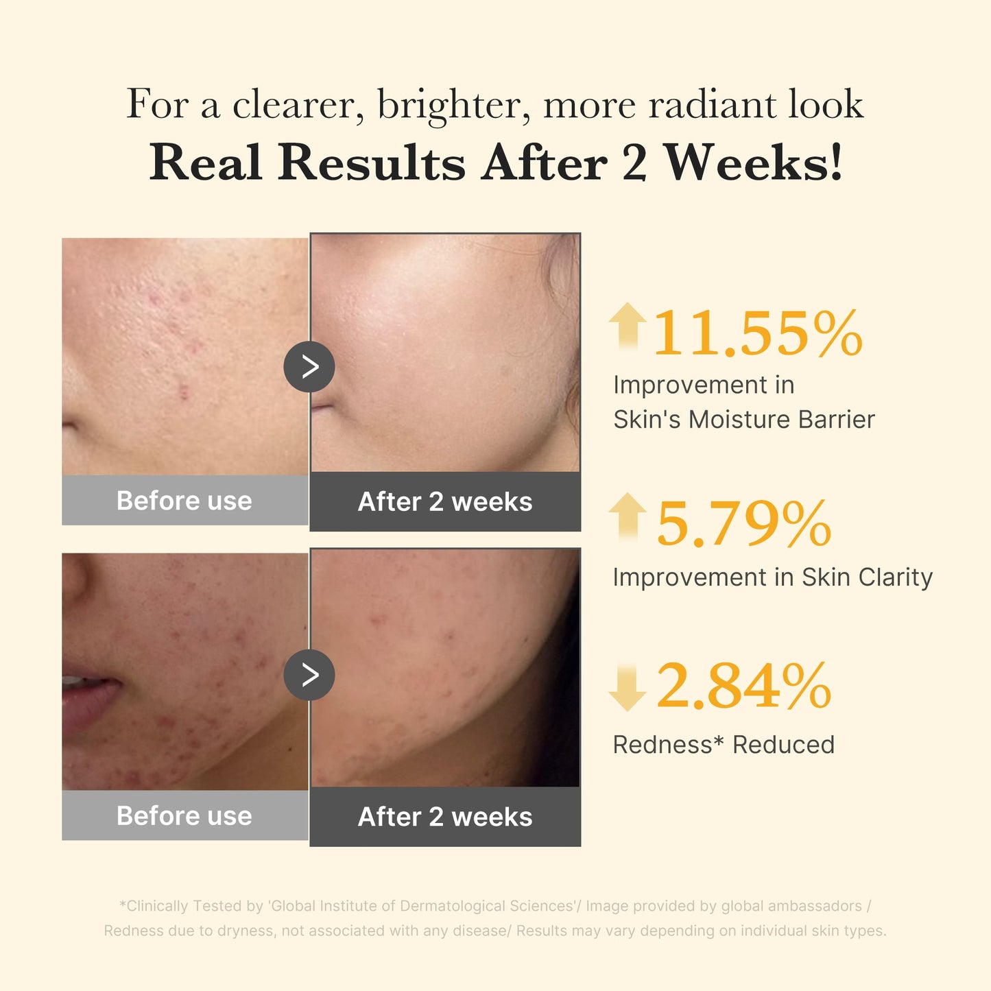 kojic-acid-turmeric-capsule-serum-r5 03_436487f5-76df-490e-8a61-01118373efbd.jpg