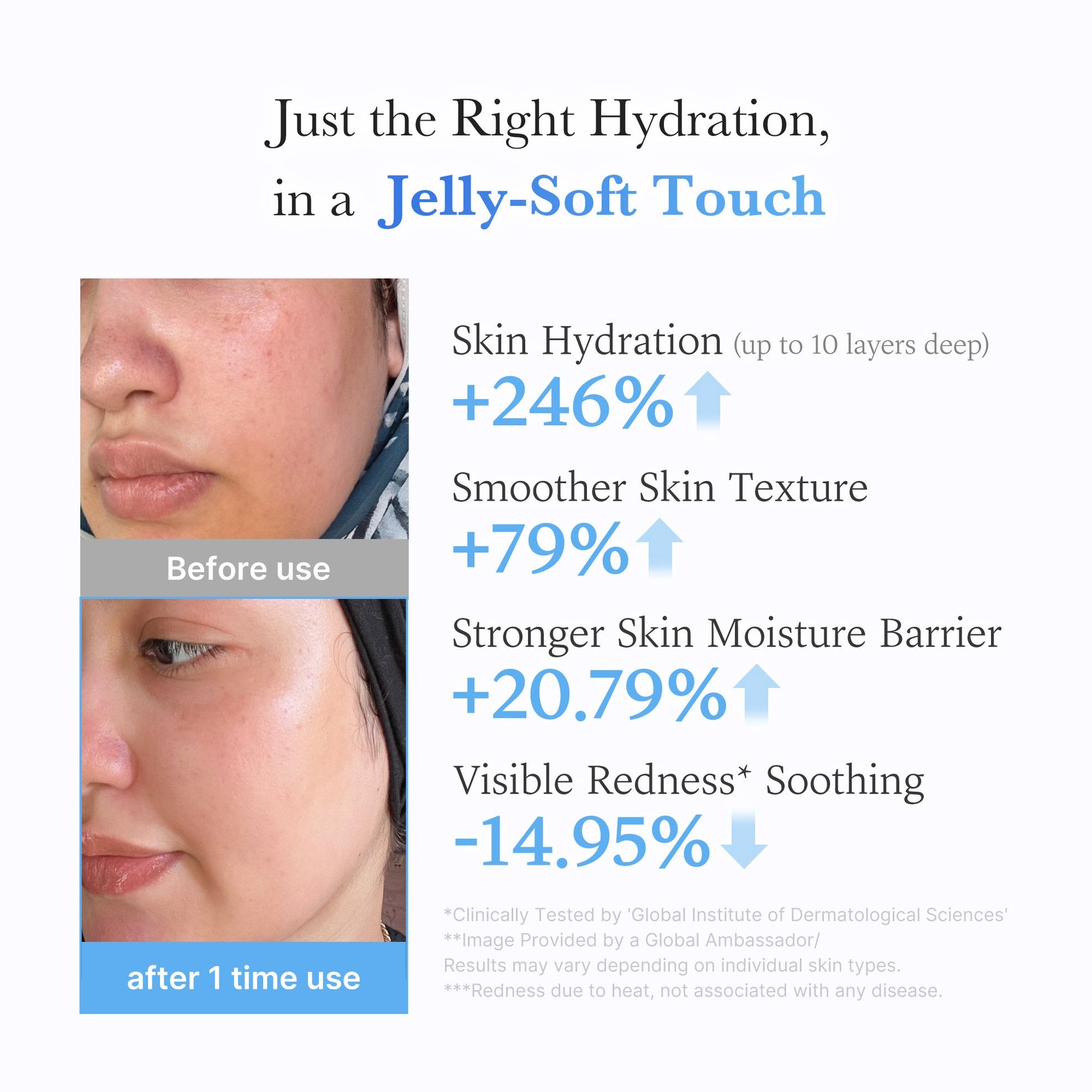 hyaluronic-ceramide-moisturizing-jelly-cream-a8 03_c39d66cc-0839-4e48-ab4a-d32143d06b1c.jpg
