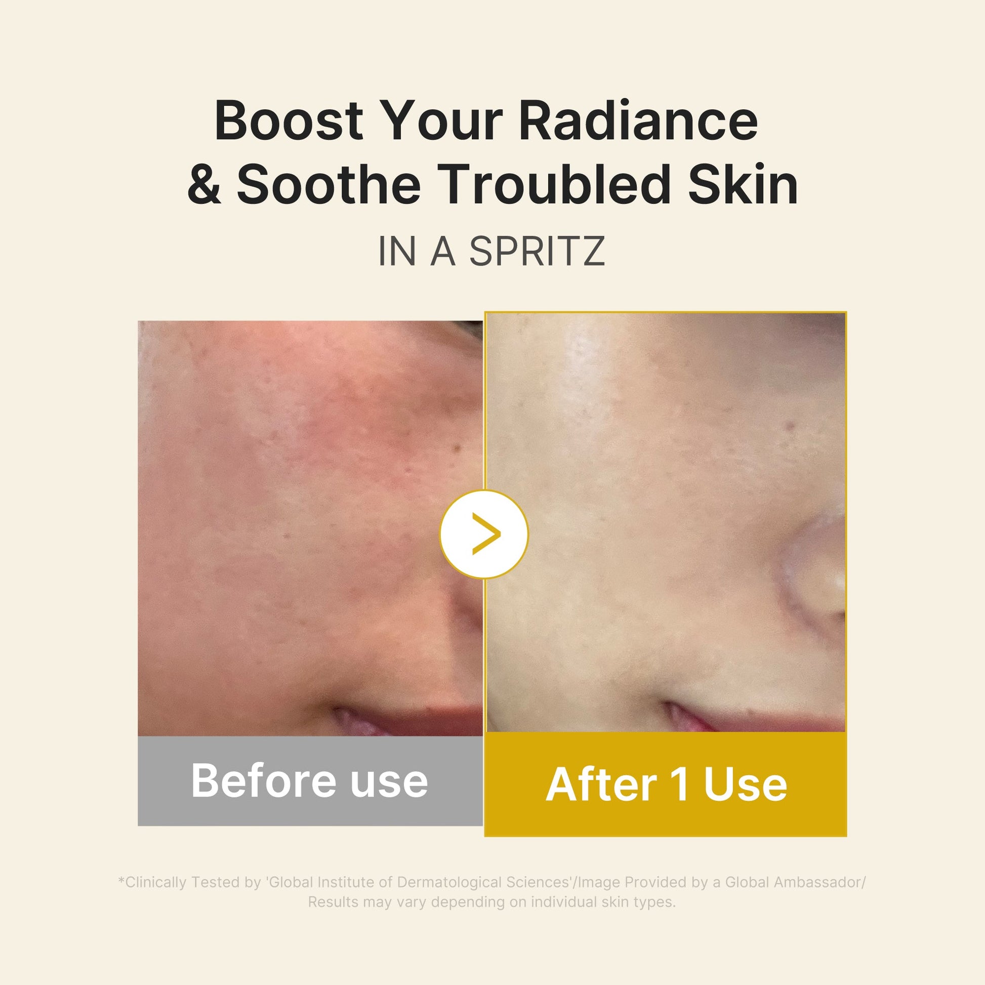 kojic-acid-turmeric-vitamin-gold-jelly-mist-serum-m7 03_dc9cd19e-4e57-49d3-9b66-c7762e8a63f1.jpg
