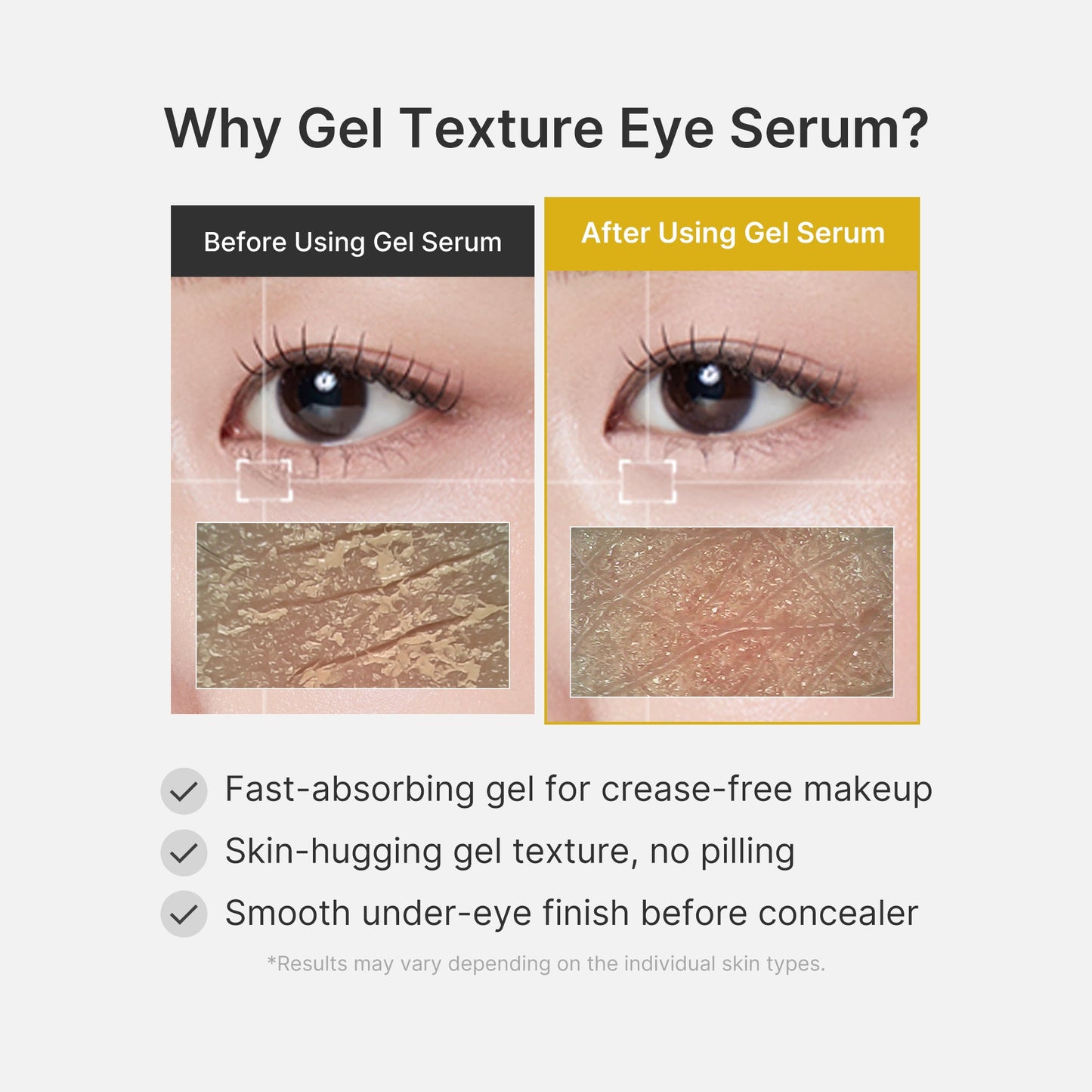 kojic-acid-tumeric-eye-gel-serum-f4 04_0487ef36-49f4-4294-8049-bb55118b05fe.jpg