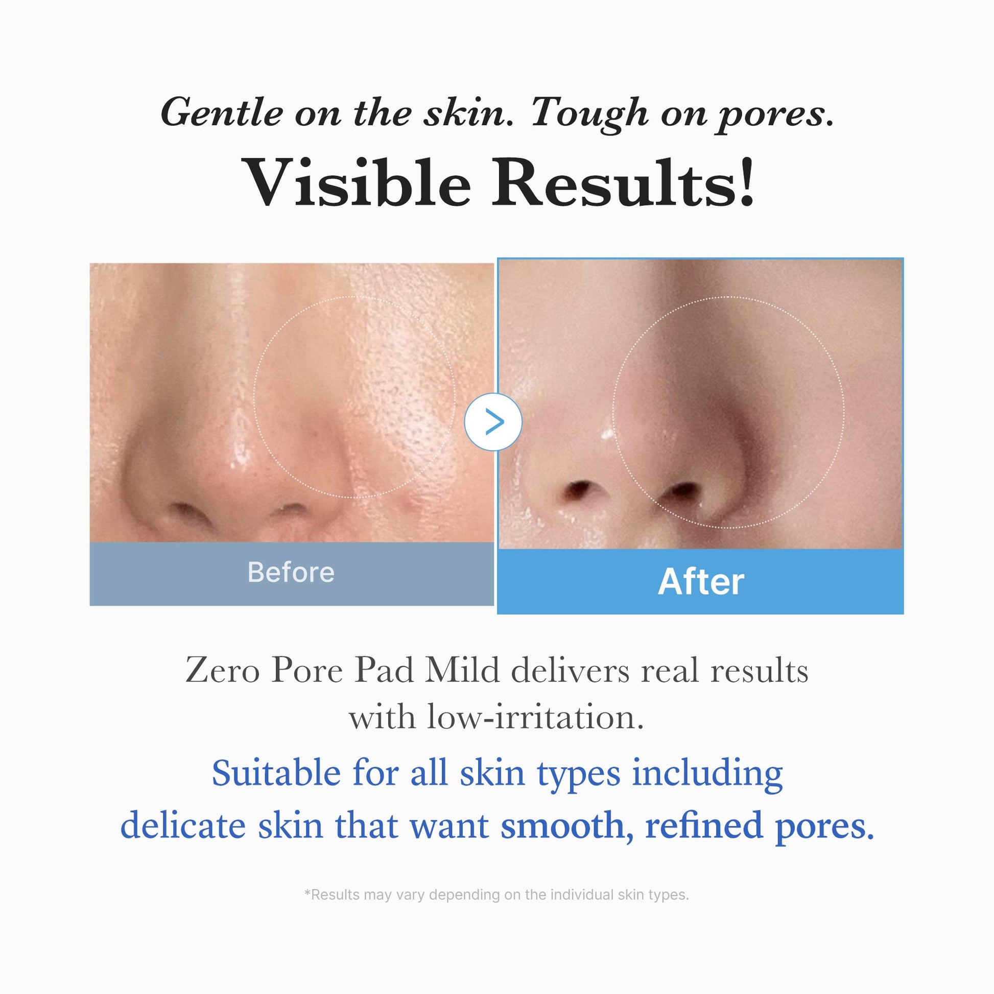 zero-pore-madecassoside-pads-mild-n5 04_6357f9f9-483b-4891-82c6-a58d336e62c8.jpg