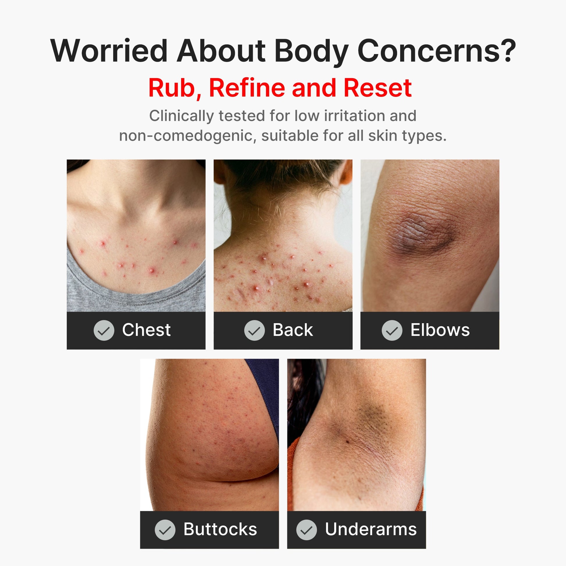 kojic-acid-turmeric-body-peel-shot-a8 04_8a7237f2-3ebf-401e-bd85-54841aeb3efc.jpg