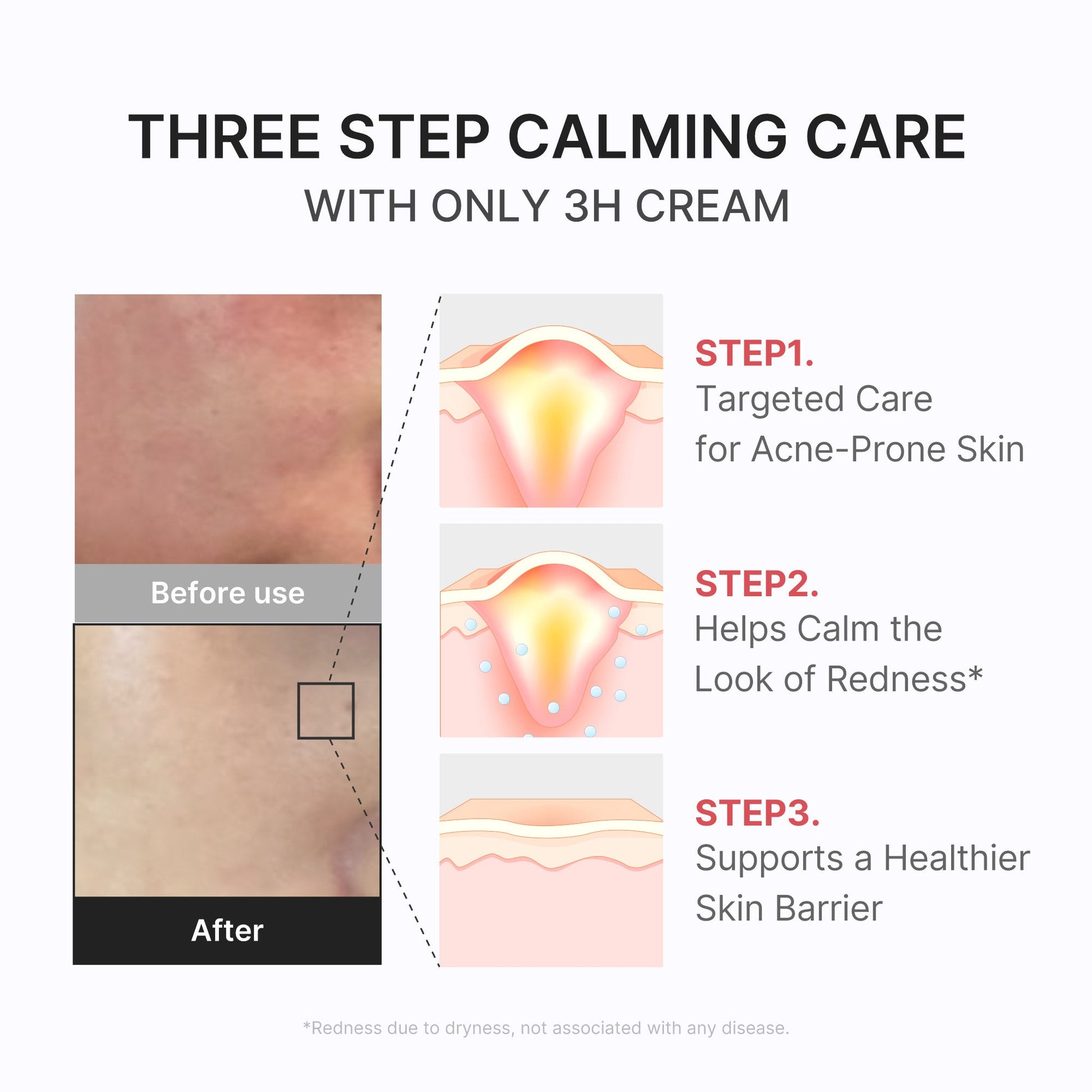 3h-daily-relief-cream-k4 3H_04.jpg