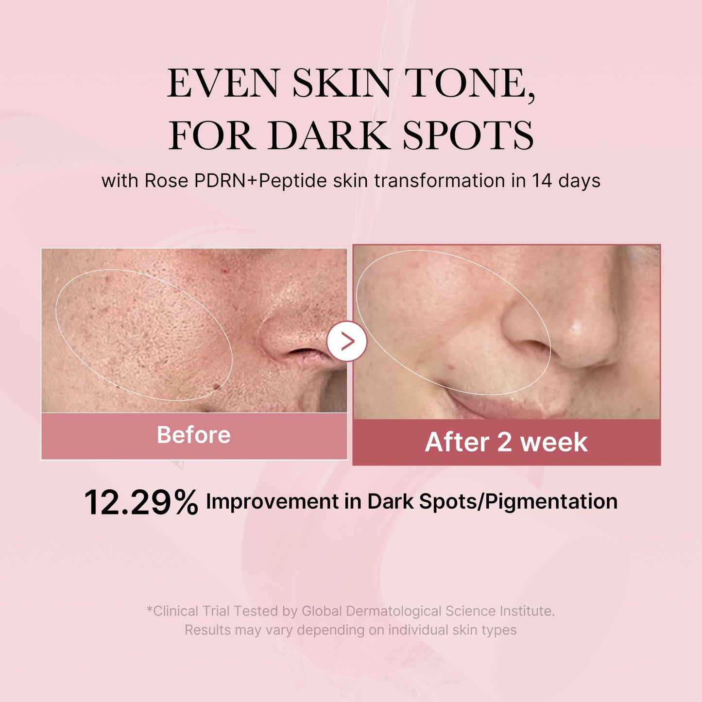 pdrn-pink-peptide-toner-n5 PDRN_01_308c518e-5ac6-4e54-99bd-eabc8796739b.jpg
