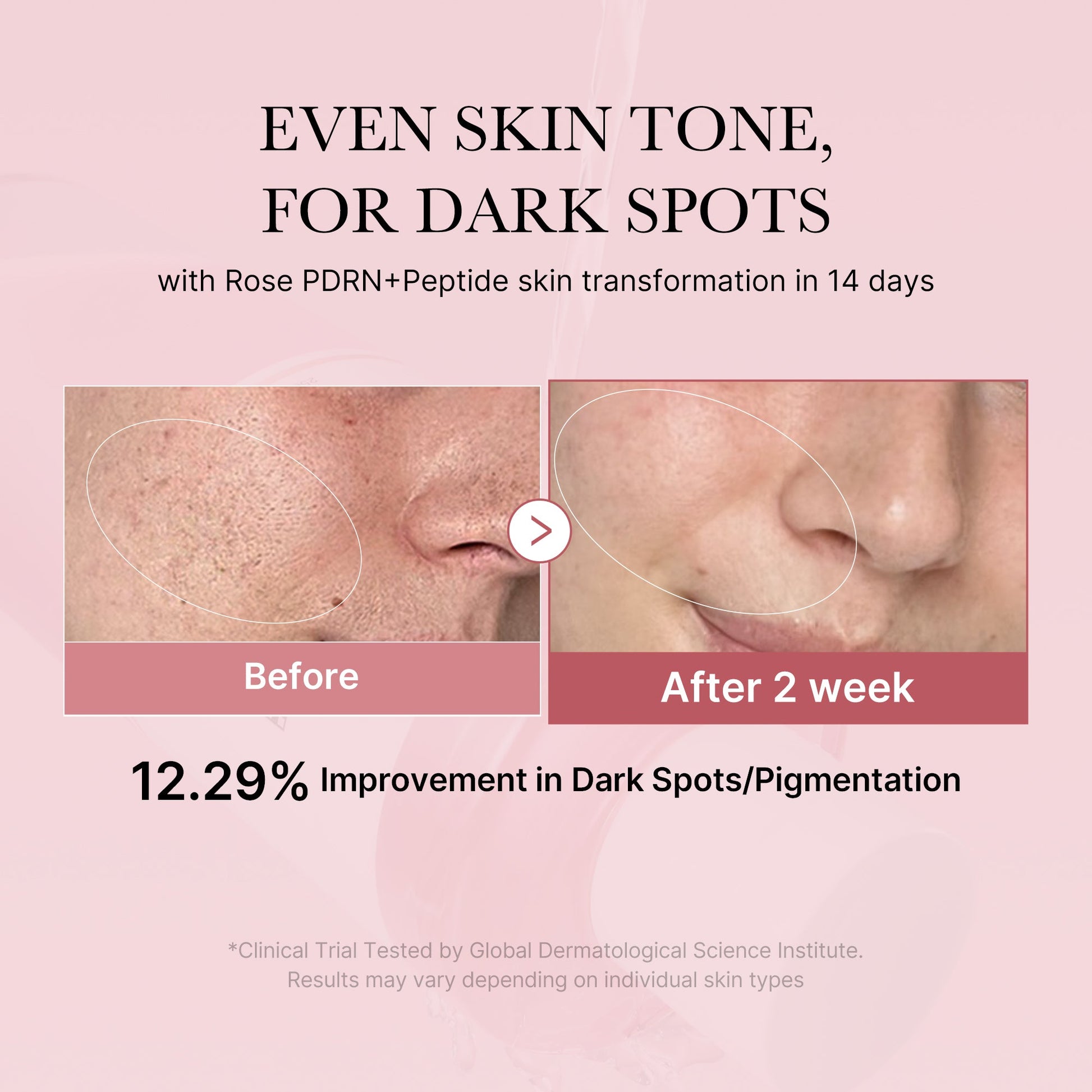 pdrn-pink-peptide-toner-n5 PDRN_01_308c518e-5ac6-4e54-99bd-eabc8796739b.jpg