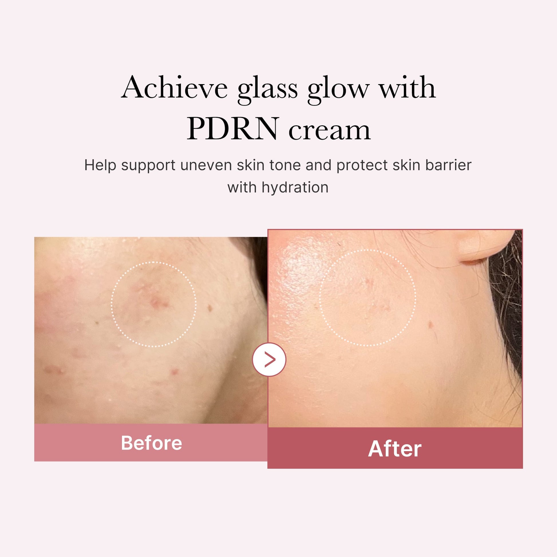 pdrn-pink-peptide-cream-v7 PDRN_02_d7805bfe-cf43-446a-b71b-a276683f136b.jpg