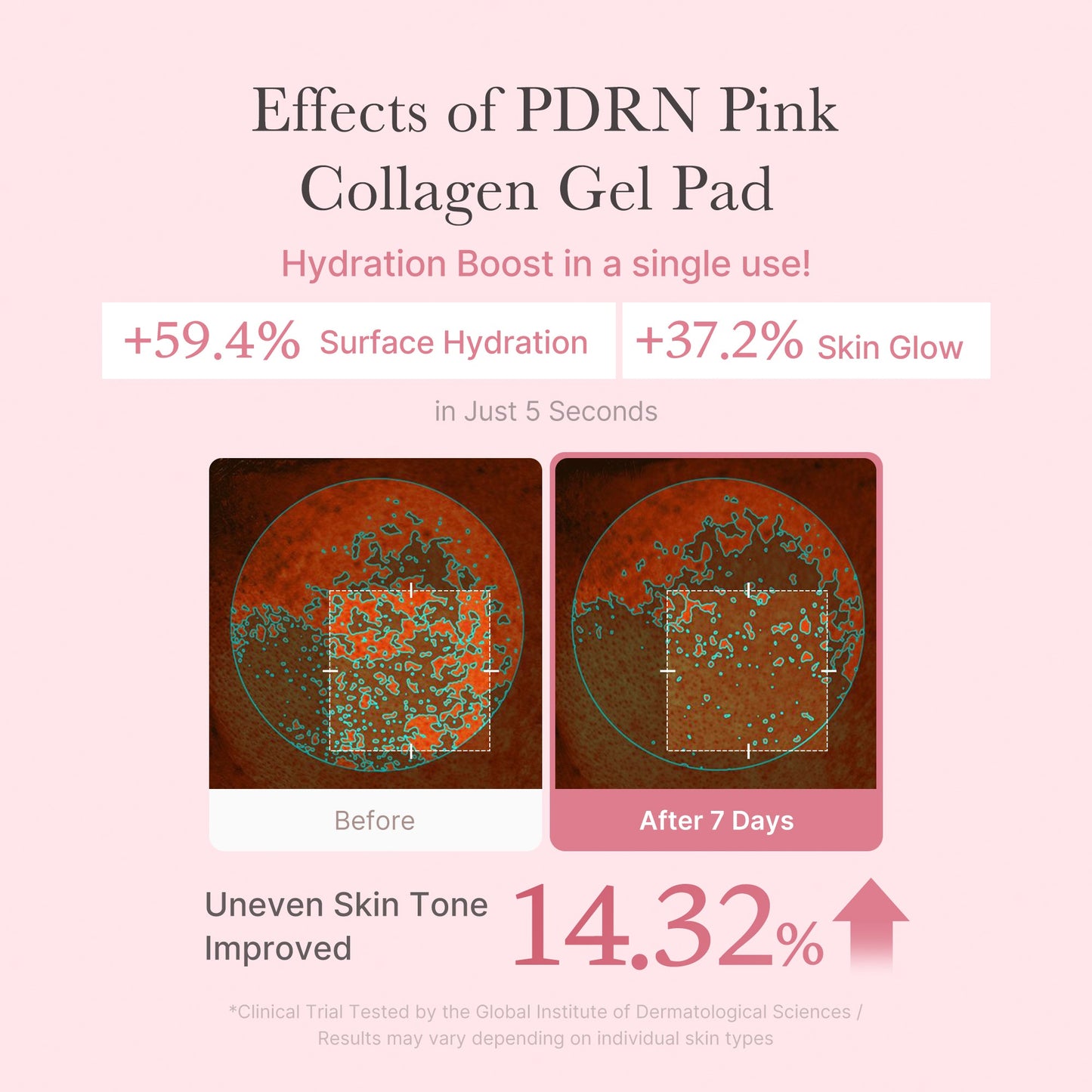 pdrn-pink-collagen-gel-toner-pad-b1 PDRN_04_f9a16a56-8d9e-4c47-a635-ed34ec3ed571.jpg