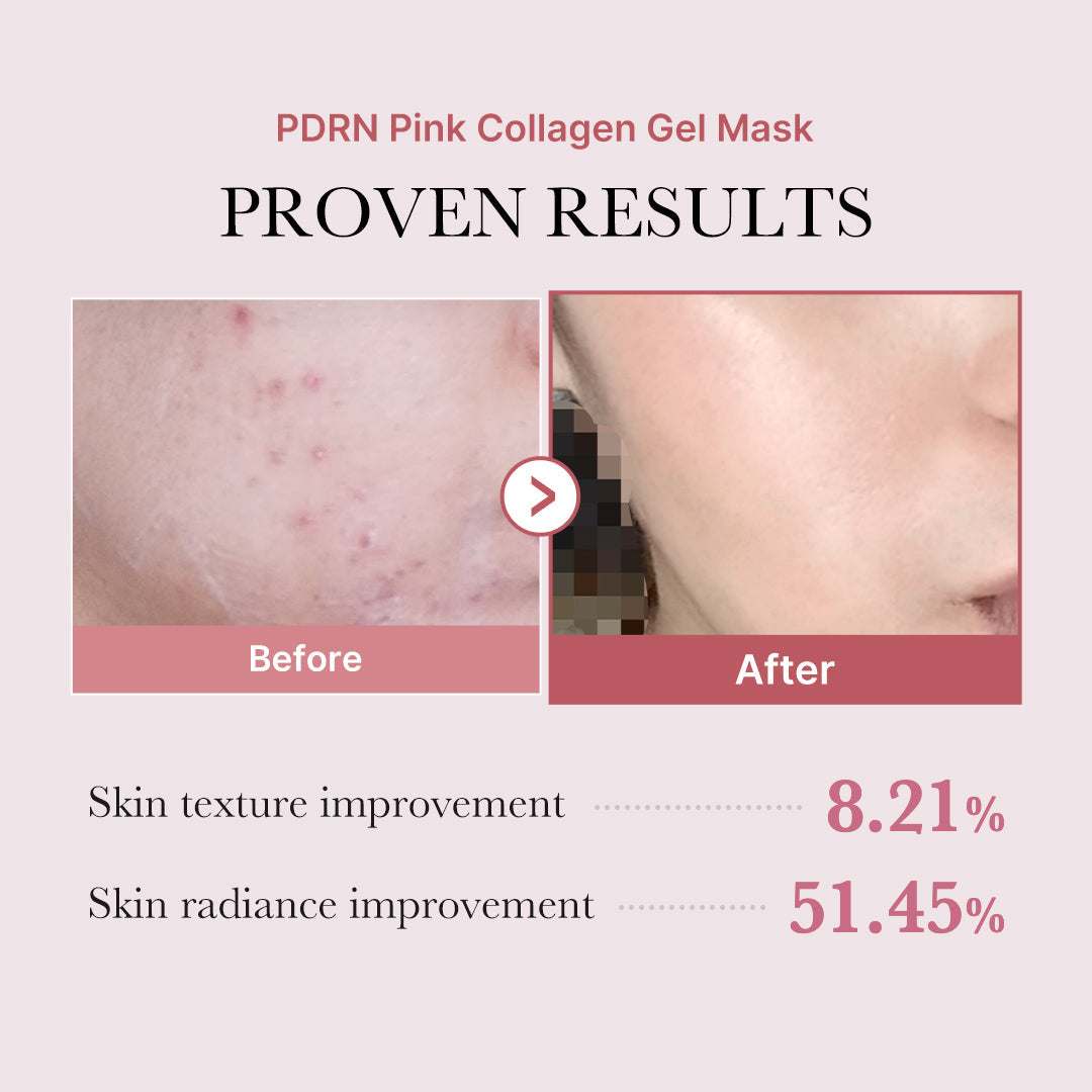salmon-pdrn-pink-collagen-jelly-gel-mask-y2 PDRN_12.jpg